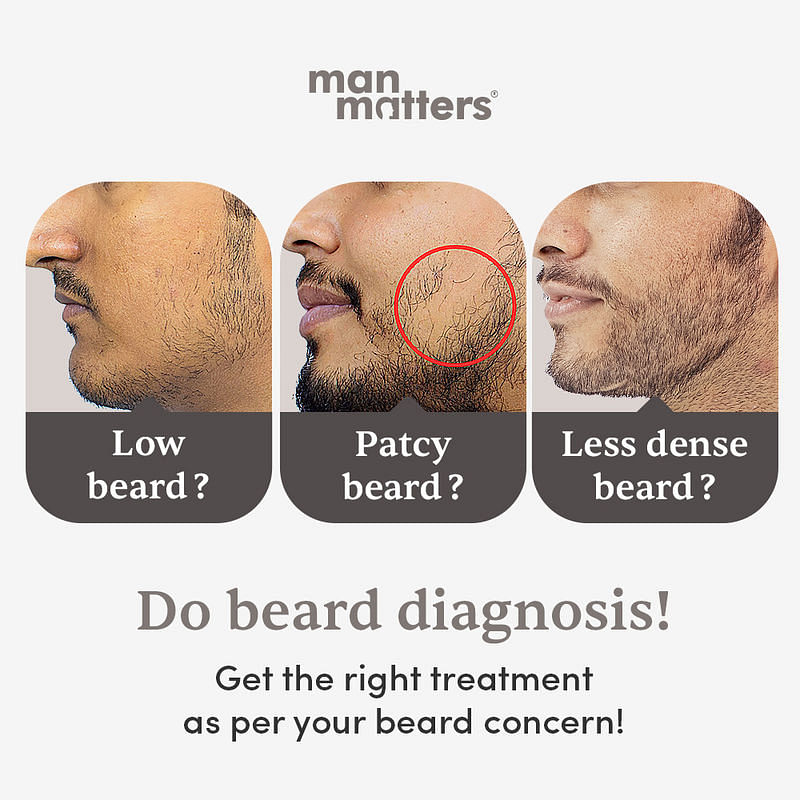 Less Dense Beard Solution