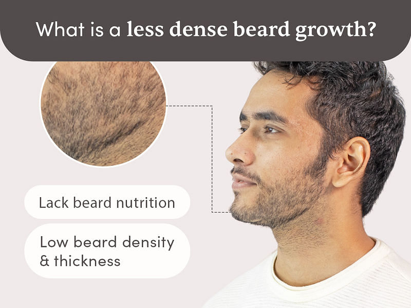 Less Dense Beard Solution