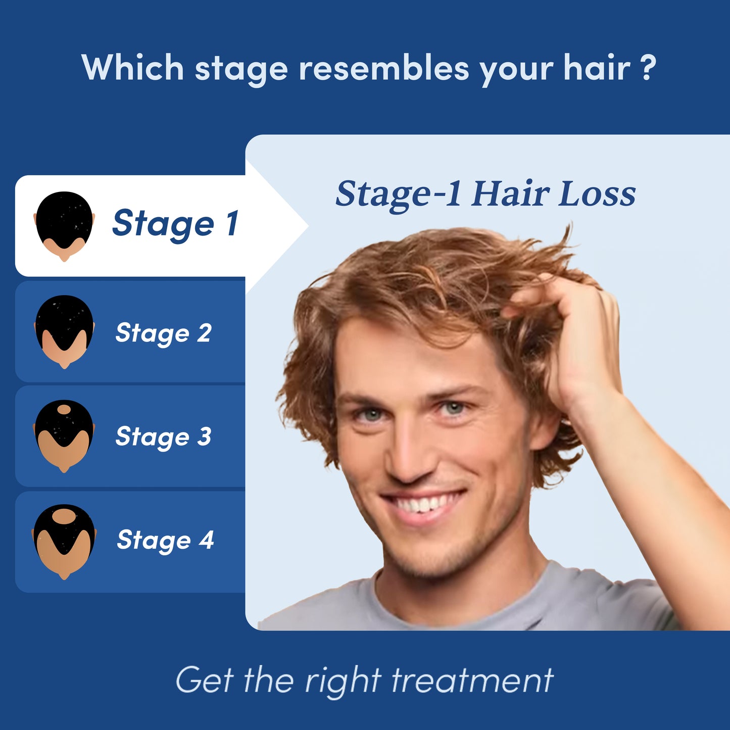 Stage 1 Hairfall Solution