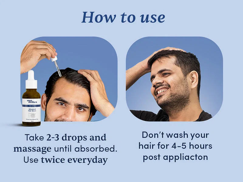 Stage 2 Hairfall Solution (3 Month Pack)