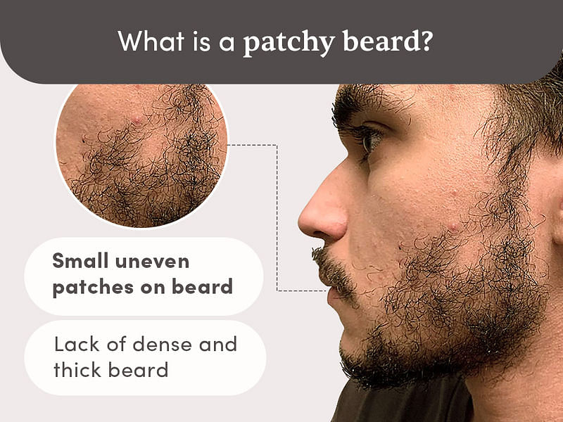 Beard Development Kit