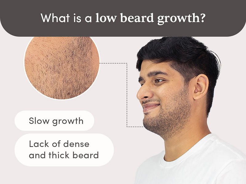 Beard Growth Kit