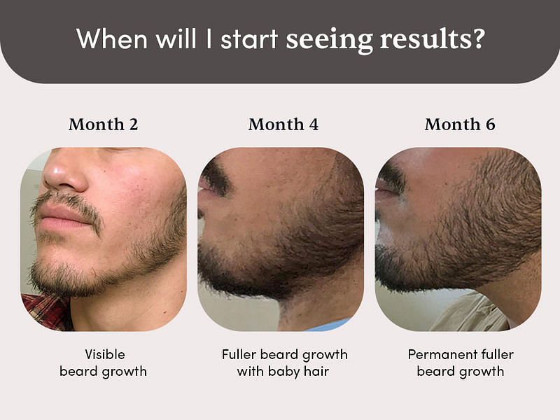 Beard Development Kit