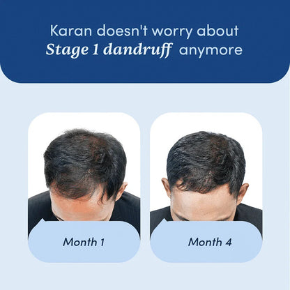 Dandruff Solution Kit